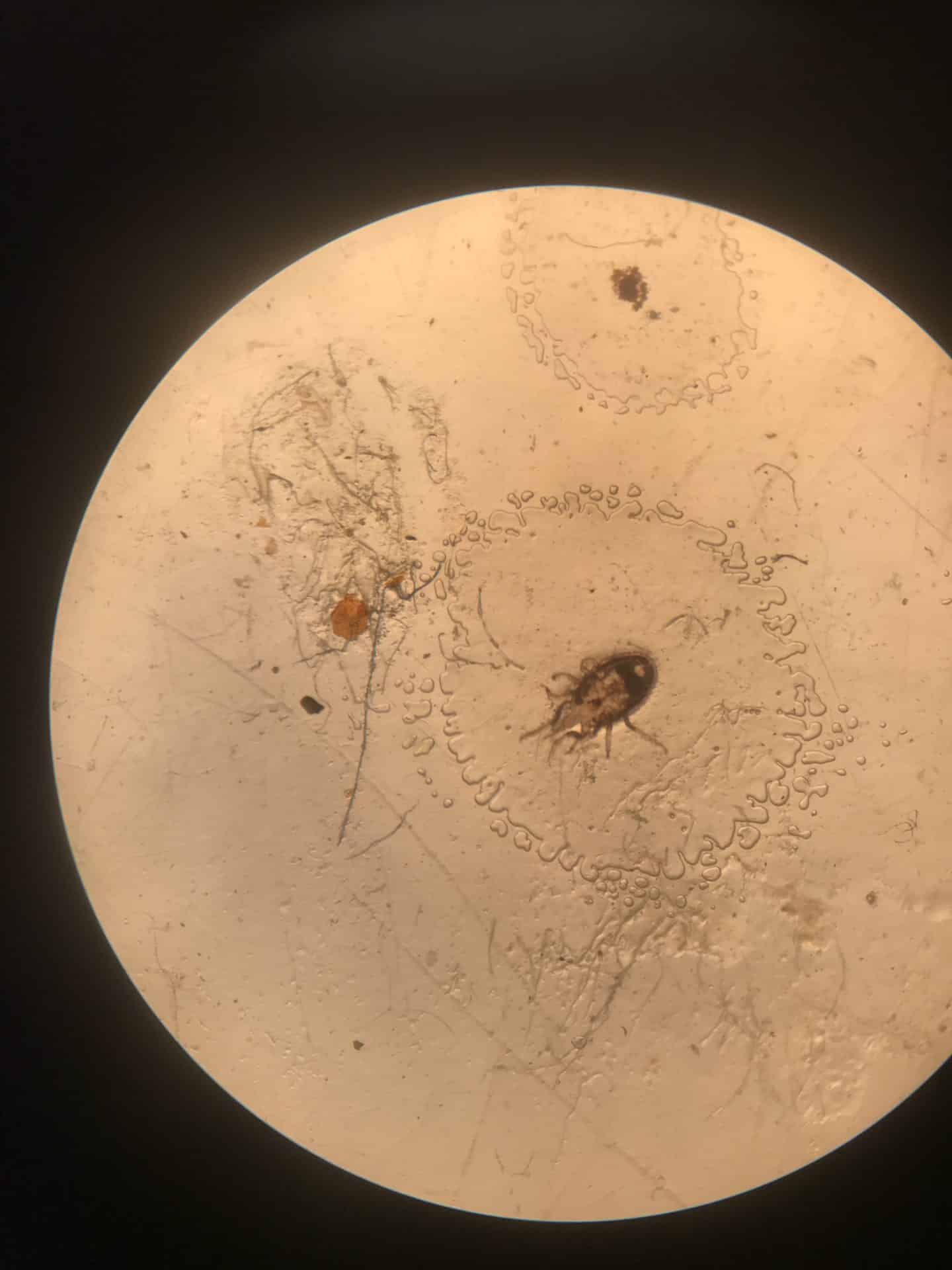What are Rat Mites? Are They Harmful to Humans?